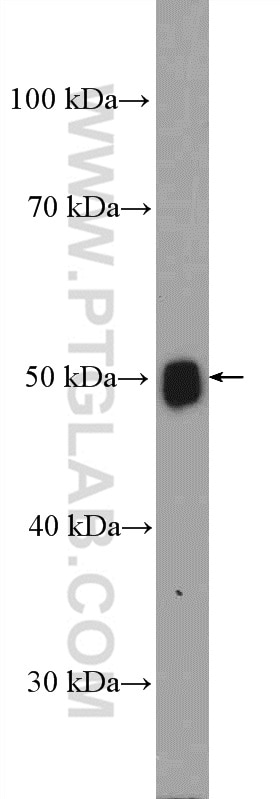 Western Blot (WB) analysis of rat brain tissue using Torsin A Polyclonal antibody (10296-1-AP)