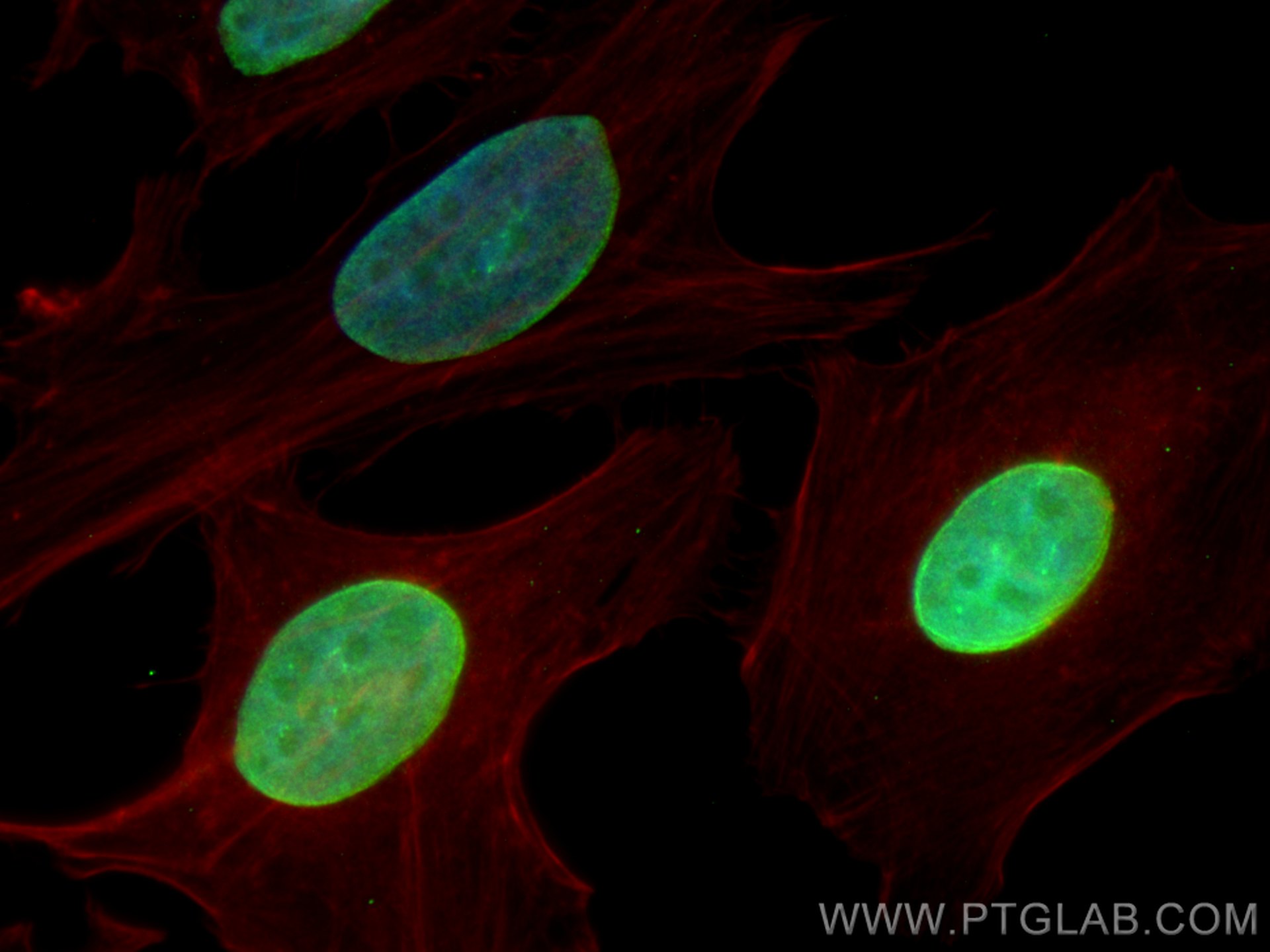 Immunofluorescence (IF) / fluorescent staining of HeLa cells using TOR1AIP1 Polyclonal antibody (21459-1-AP)