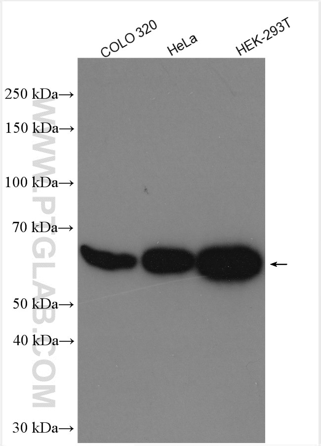 Western Blot (WB) analysis of various lysates using TOR1AIP1 Polyclonal antibody (21459-1-AP)