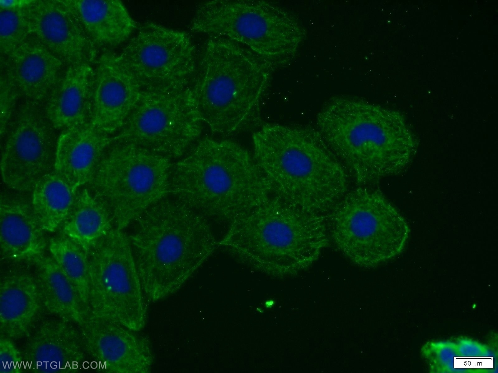 Immunofluorescence (IF) / fluorescent staining of A431 cells using TOR1AIP2 Polyclonal antibody (24769-1-AP)