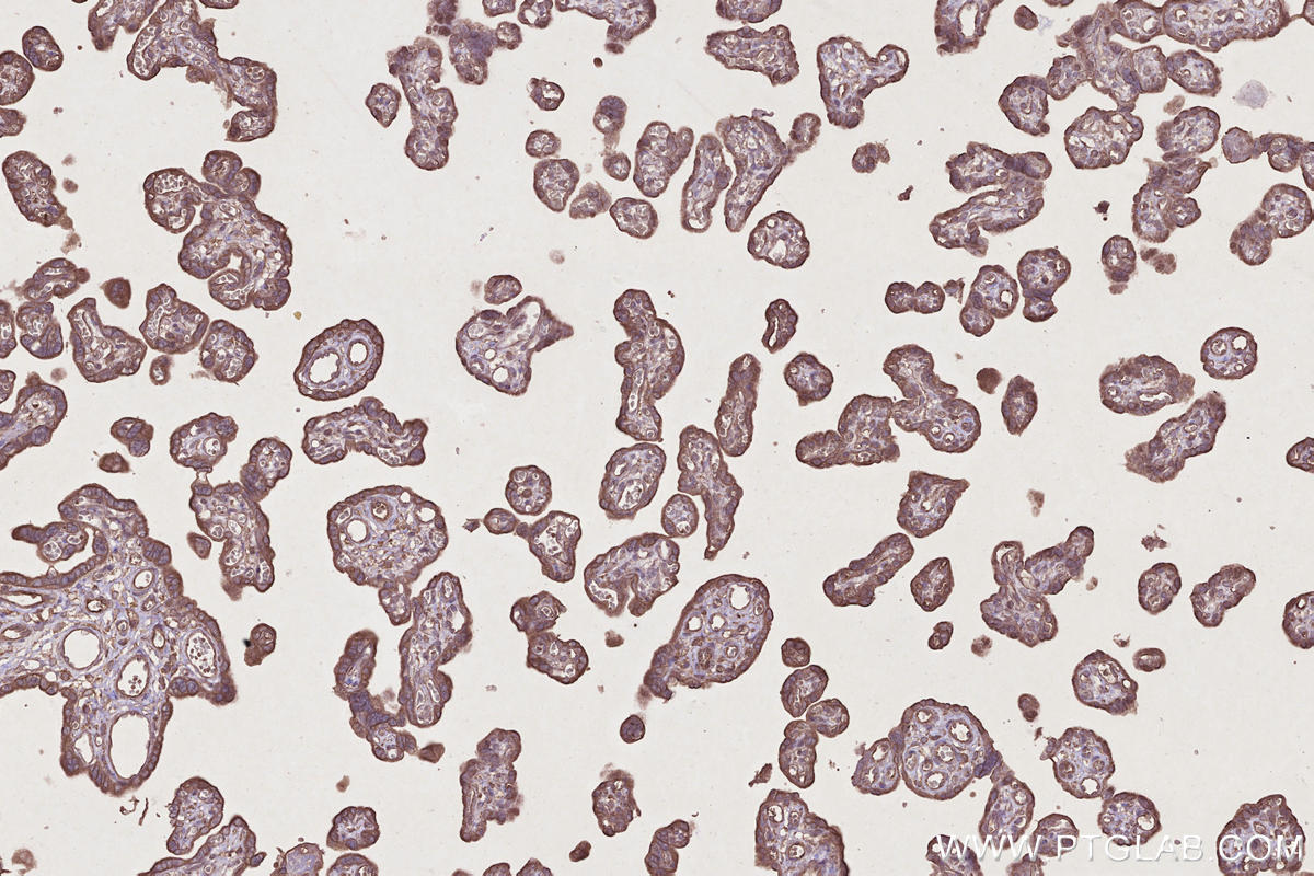 Immunohistochemistry (IHC) staining of human placenta tissue using TOR1AIP2 Polyclonal antibody (24769-1-AP)