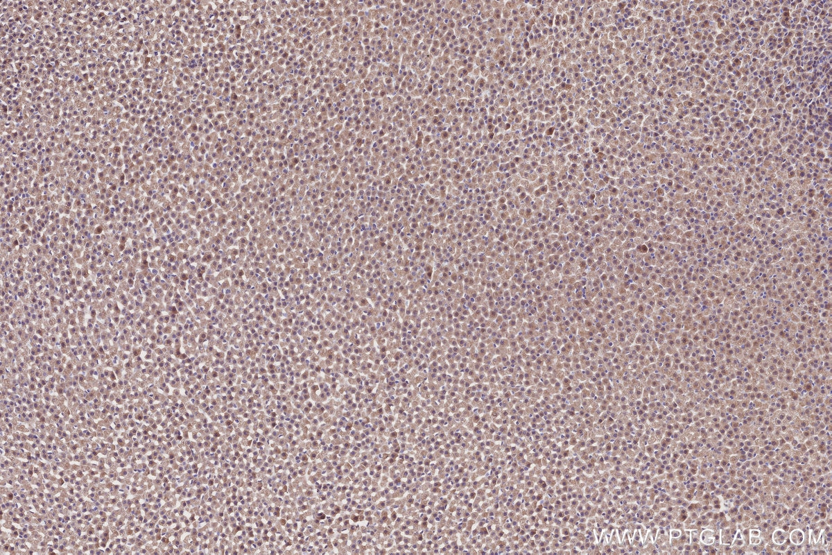 Immunohistochemistry (IHC) staining of rat adrenal gland tissue using TOR1AIP2 Polyclonal antibody (24769-1-AP)