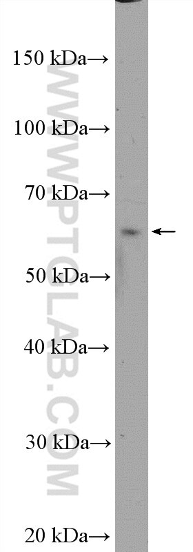 WB analysis of HepG2 using 24769-1-AP