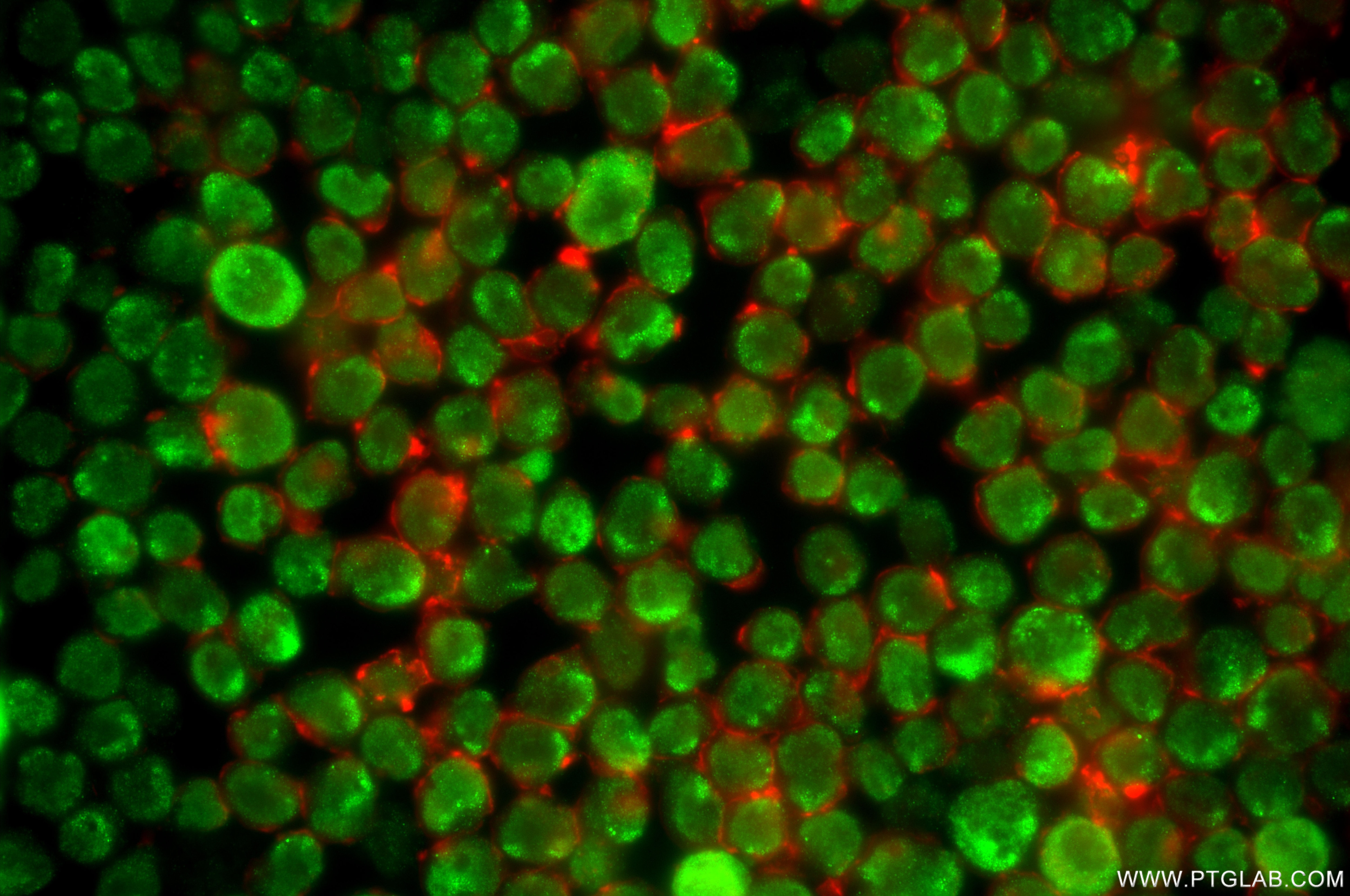 Immunofluorescence (IF) / fluorescent staining of Jurkat cells using TORC1/CRTC1 Recombinant monoclonal antibody (86226-3-RR)