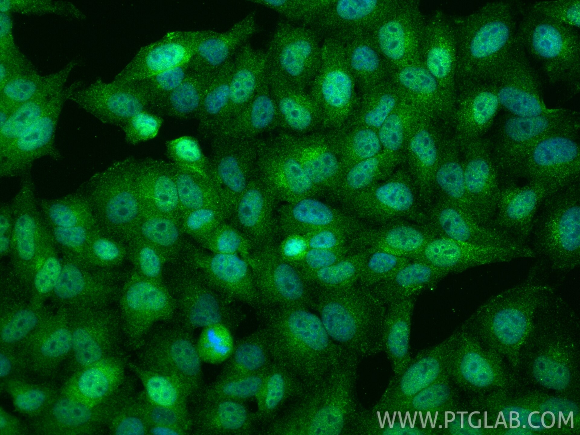 IF Staining of HepG2 using RMX00047 Immunofluorescence (IF) / fluorescent staining of HepG2 cells using Multi-rAb® TORC2 Multi-Recombinant antibody (RMX00047)