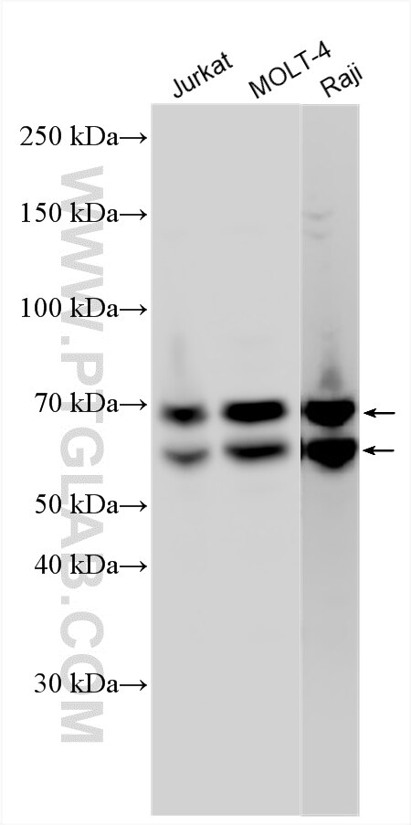 WB analysis using 34301-1-AP (same clone as 34301-1-PBS) Western Blot (WB) analysis of various lysates using TOX Polyclonal antibody (34301-1-AP)