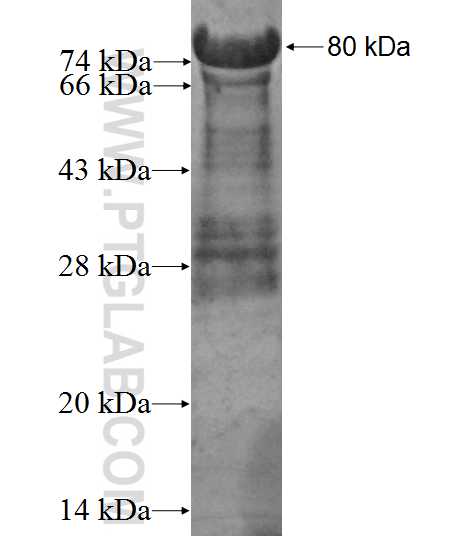 TOX fusion protein Ag3171 SDS-PAGE