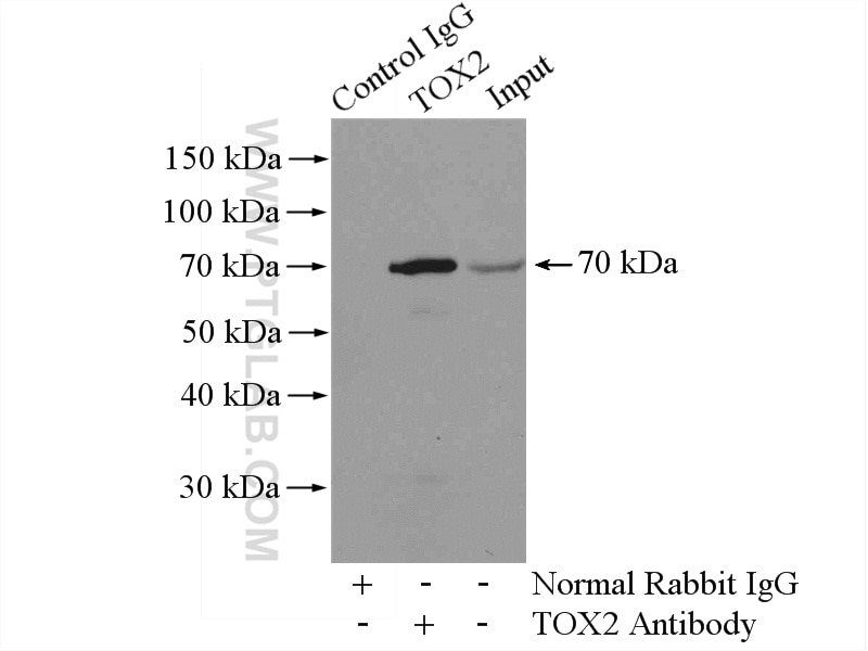 Immunoprecipitation (IP) experiment of mouse liver tissue using TOX2 Polyclonal antibody (21162-1-AP)