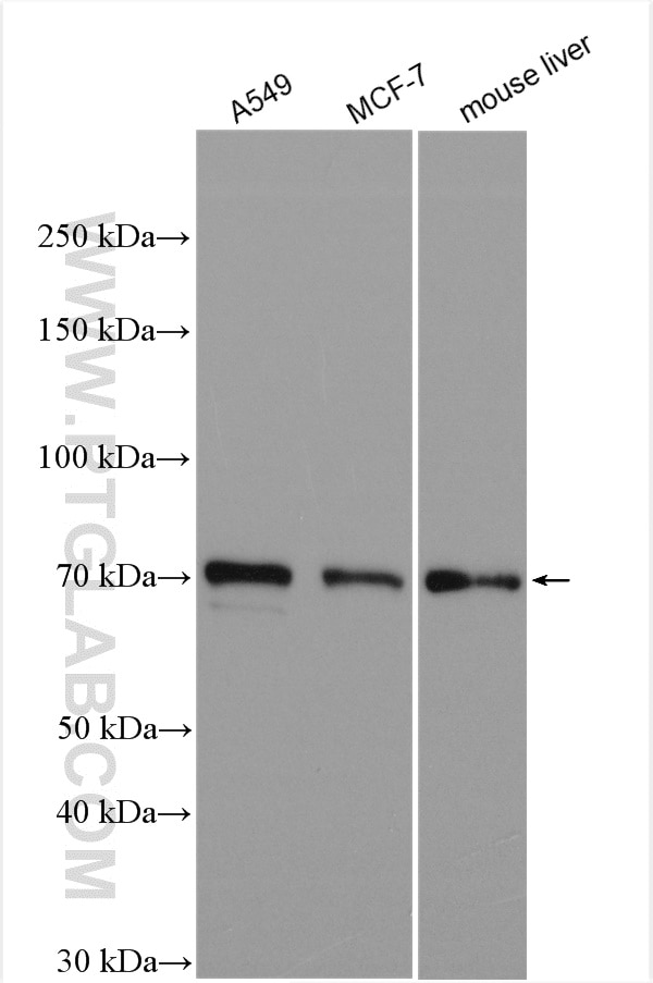 Western Blot (WB) analysis of various lysates using TOX2 Polyclonal antibody (21162-1-AP)
