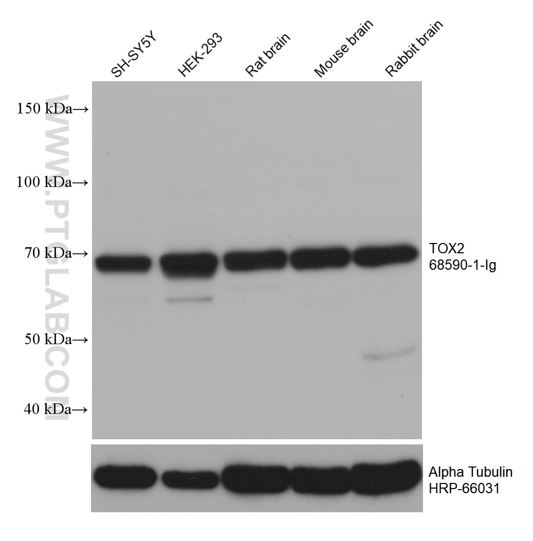 Western Blot (WB) analysis of various lysates using TOX2 Monoclonal antibody (68590-1-Ig)