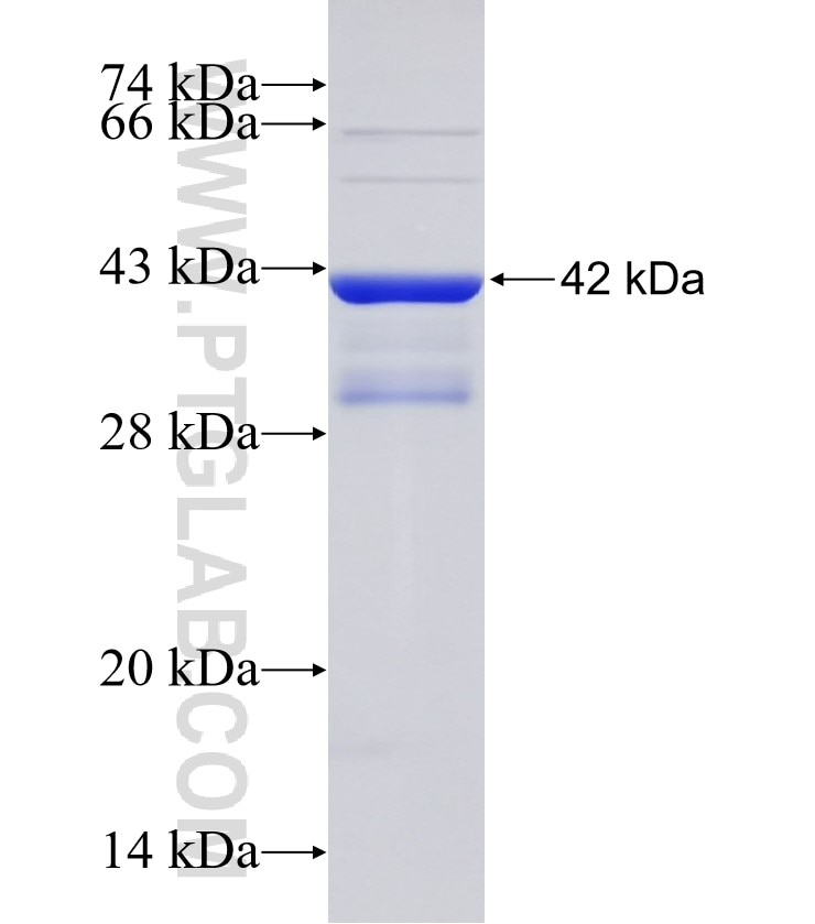 TOX2 fusion protein Ag31226 SDS-PAGE