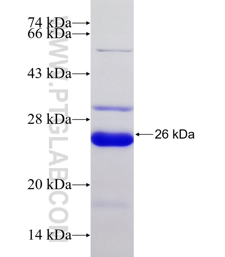 TOX2 fusion protein Ag31563 SDS-PAGE
