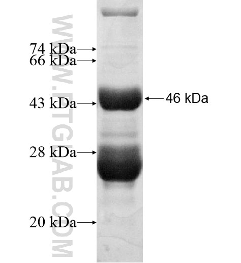 TOX2 fusion protein Ag14772 SDS-PAGE