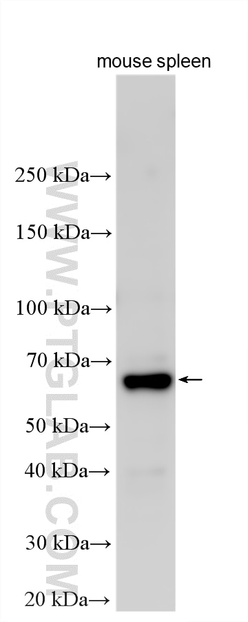 Western Blot (WB) analysis of various lysates using TOX3 Polyclonal antibody (28338-1-AP)