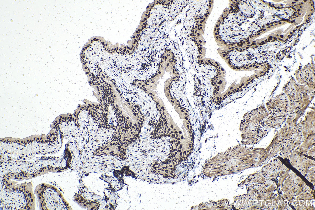 Immunohistochemistry (IHC) staining of mouse bladder tissue using TOX4 Polyclonal antibody (27988-1-AP)