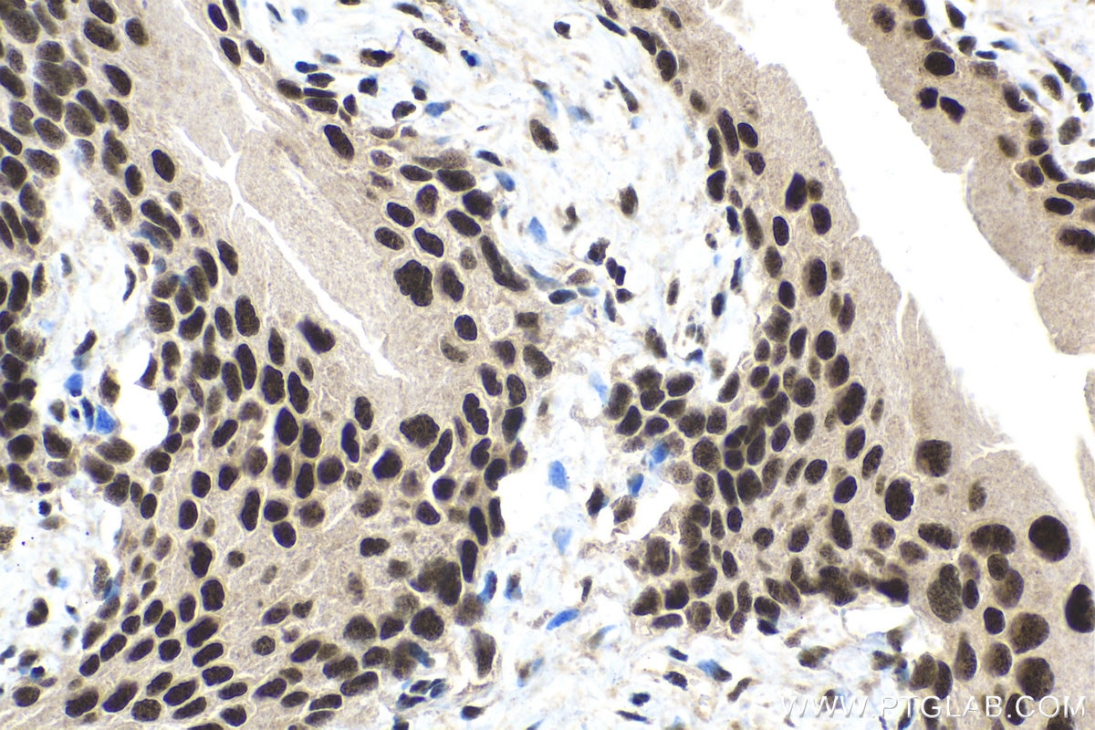 Immunohistochemistry (IHC) staining of mouse bladder tissue using TOX4 Polyclonal antibody (27988-1-AP)
