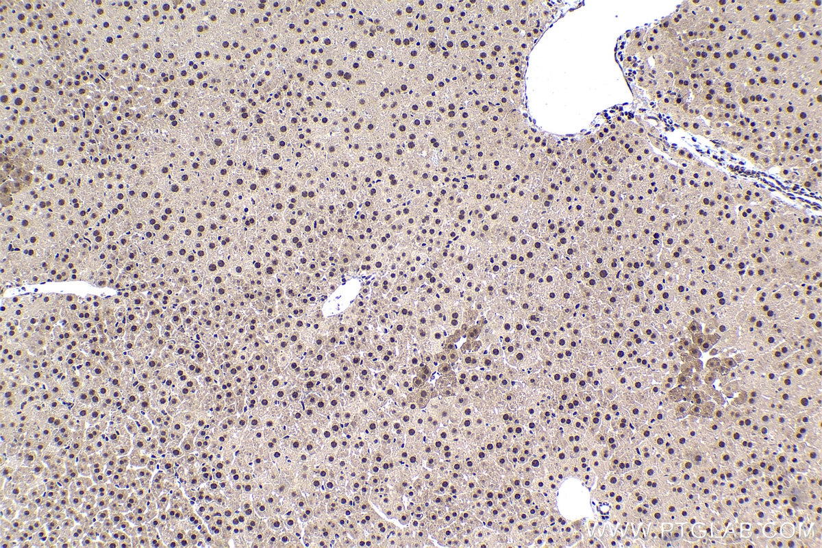 Immunohistochemistry (IHC) staining of mouse liver tissue using TOX4 Polyclonal antibody (27988-1-AP)