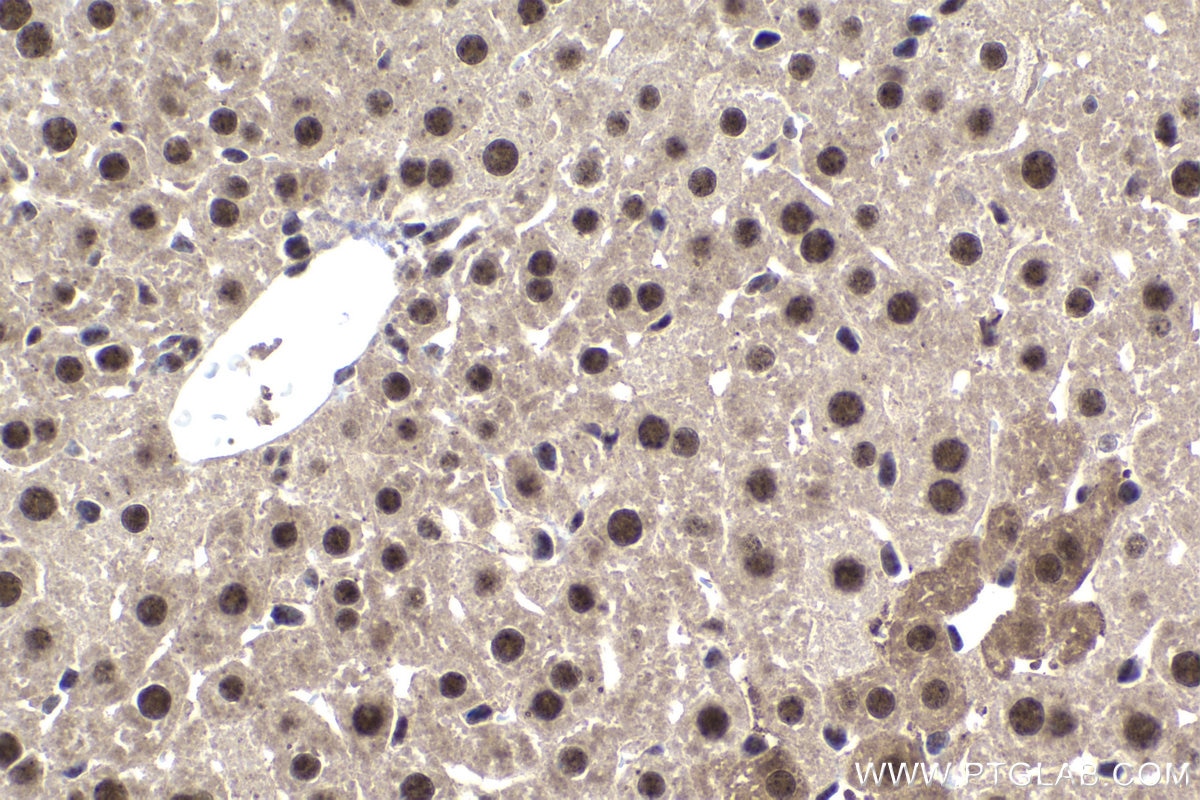 Immunohistochemistry (IHC) staining of mouse liver tissue using TOX4 Polyclonal antibody (27988-1-AP)
