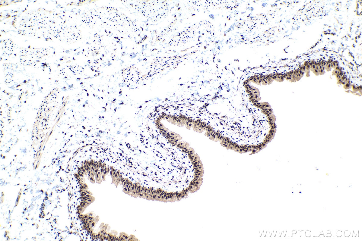 IHC staining of rat bladder using 27988-1-AP