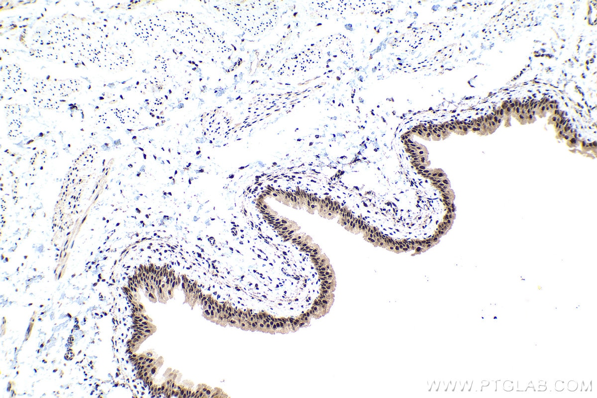 Immunohistochemistry (IHC) staining of rat bladder tissue using TOX4 Polyclonal antibody (27988-1-AP)