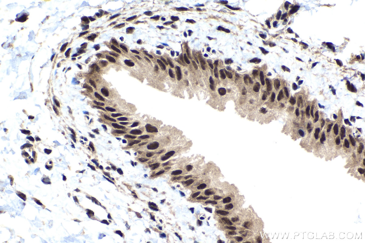 Immunohistochemistry (IHC) staining of rat bladder tissue using TOX4 Polyclonal antibody (27988-1-AP)