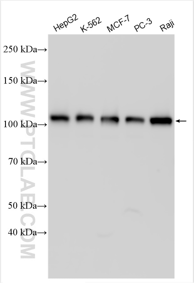 Western Blot (WB) analysis of various lysates using TOX4 Polyclonal antibody (27988-1-AP)