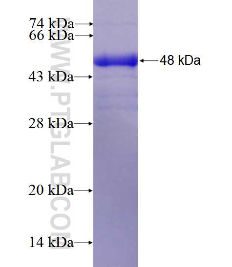 TOX4 fusion protein Ag27638 SDS-PAGE