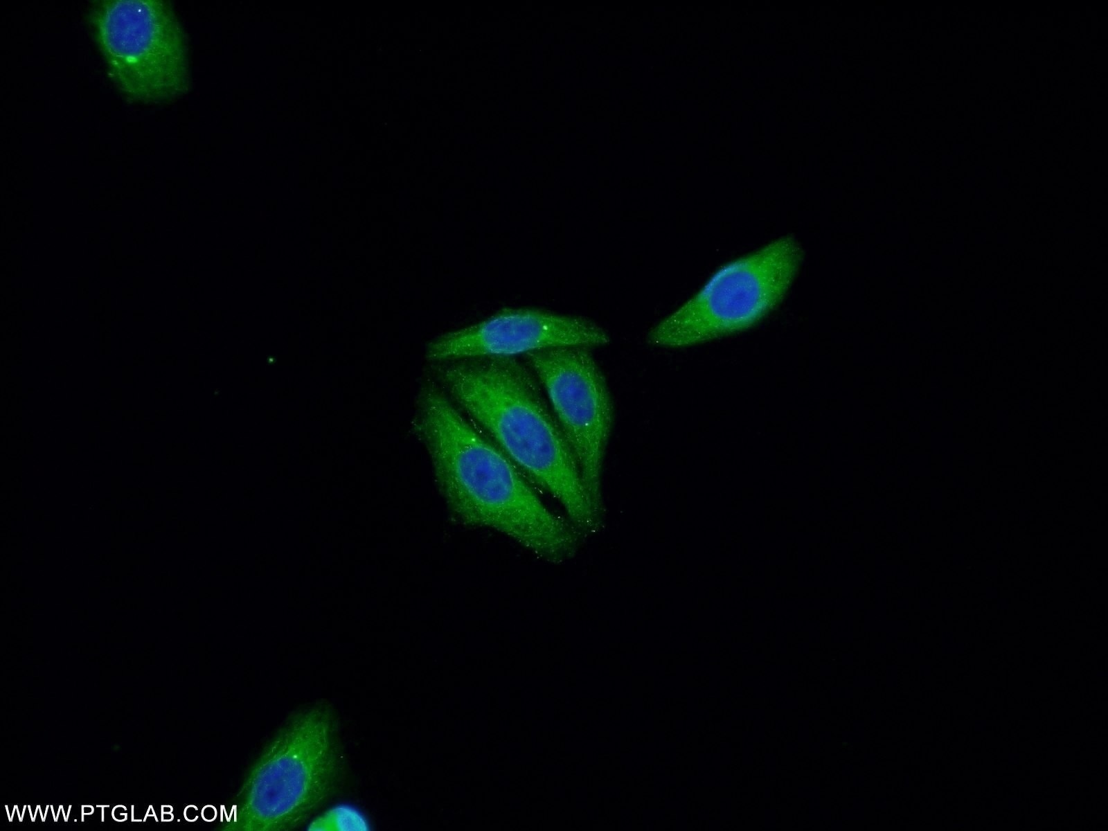 Immunofluorescence (IF) / fluorescent staining of HepG2 cells using P53 Polyclonal antibody (21891-1-AP)