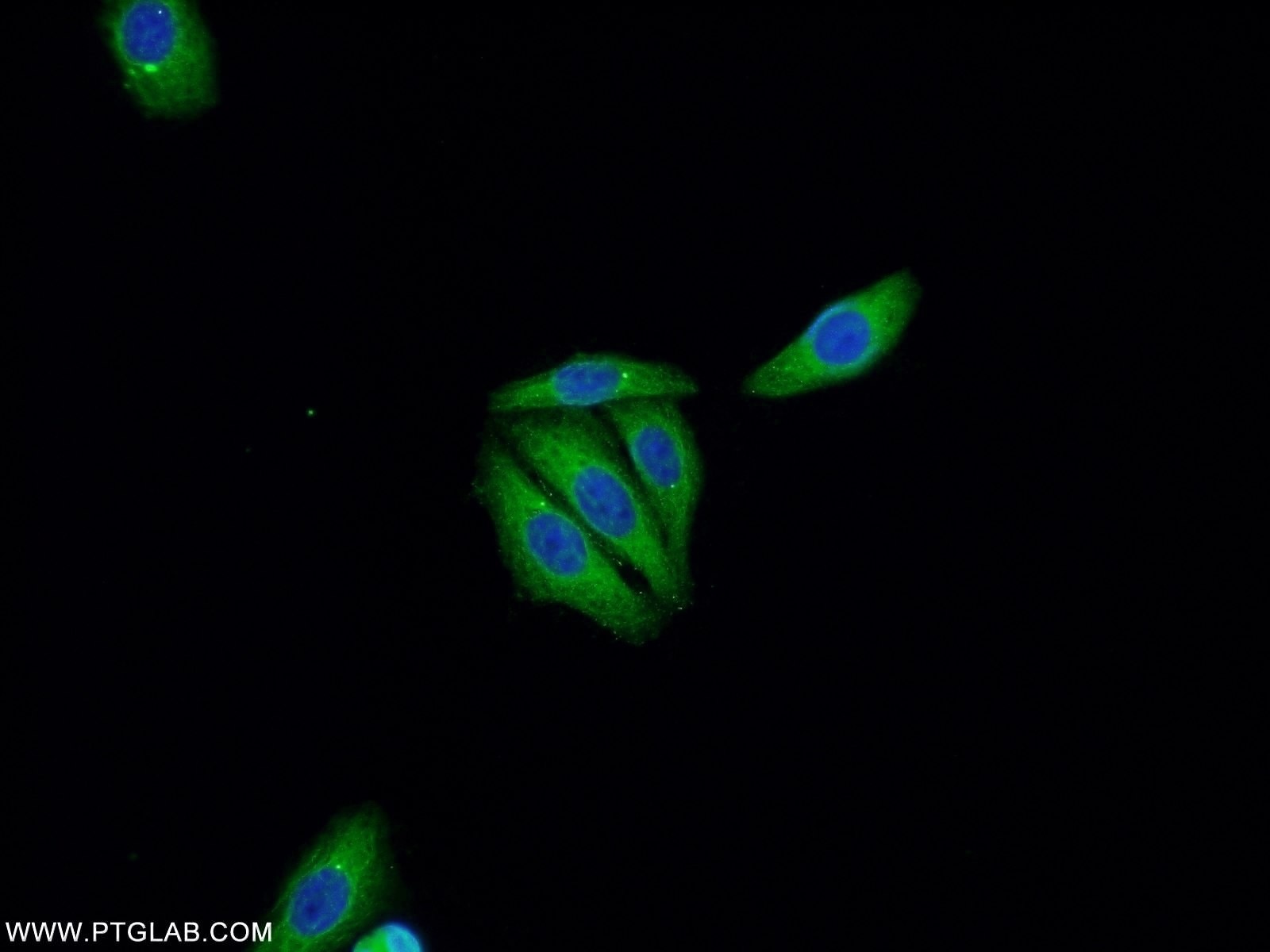 IF Staining of HepG2 using 21891-1-AP