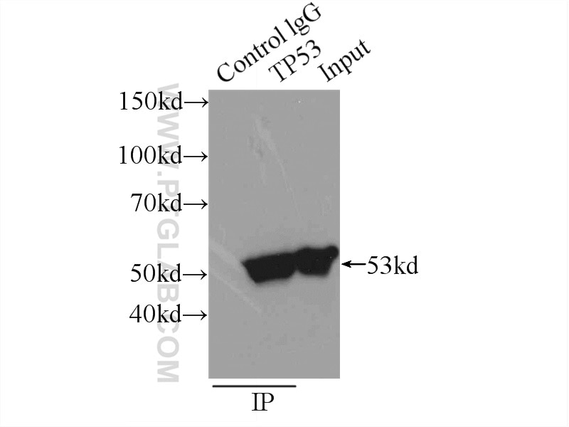 Immunoprecipitation (IP) experiment of A431 cells using P53 Polyclonal antibody (21891-1-AP)