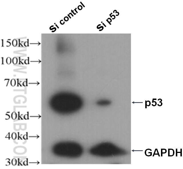 Western Blot (WB) analysis of A431 cells using P53 Polyclonal antibody (21891-1-AP)