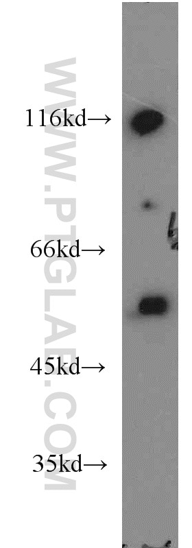 Western Blot (WB) analysis of HEK-293 cells using P53 Polyclonal antibody (21891-1-AP)
