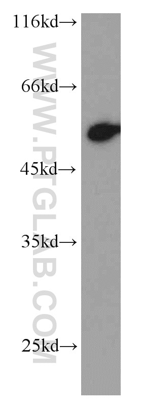 Western Blot (WB) analysis of A431 cells using P53 Polyclonal antibody (21891-1-AP)