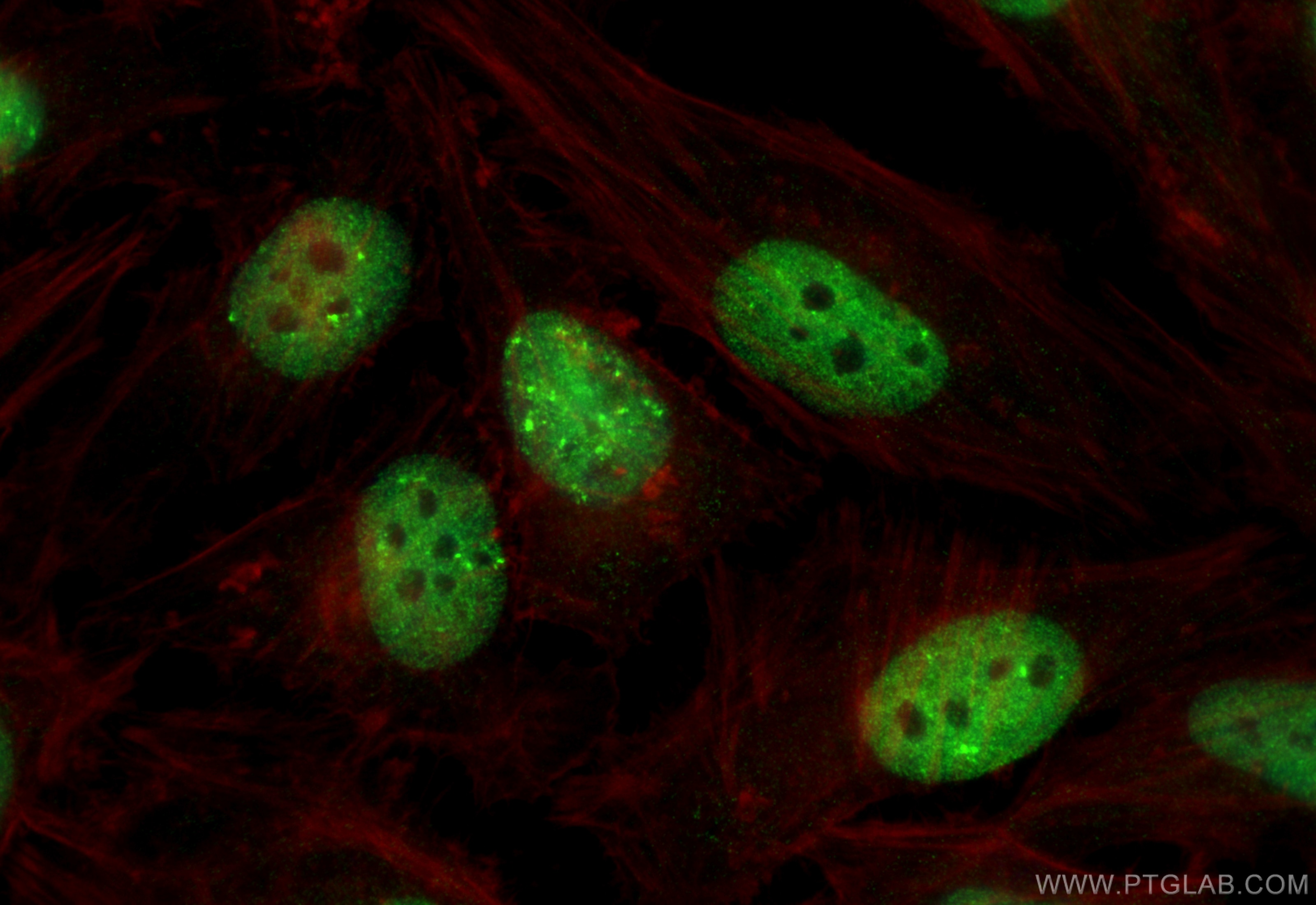 Immunofluorescence (IF) / fluorescent staining of HeLa cells using TP53BP1-Specific Polyclonal antibody (20002-1-AP)