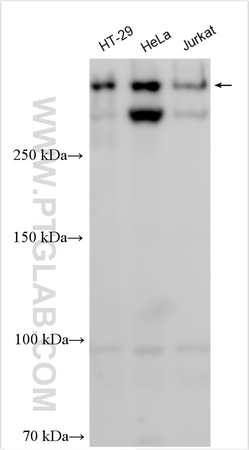Western Blot (WB) analysis of various lysates using TP53BP1-Specific Polyclonal antibody (20002-1-AP)