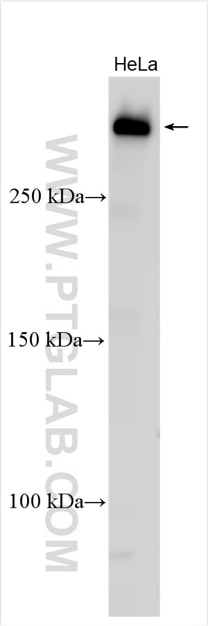 Western Blot (WB) analysis of various lysates using TP53BP1-Specific Polyclonal antibody (20002-1-AP)