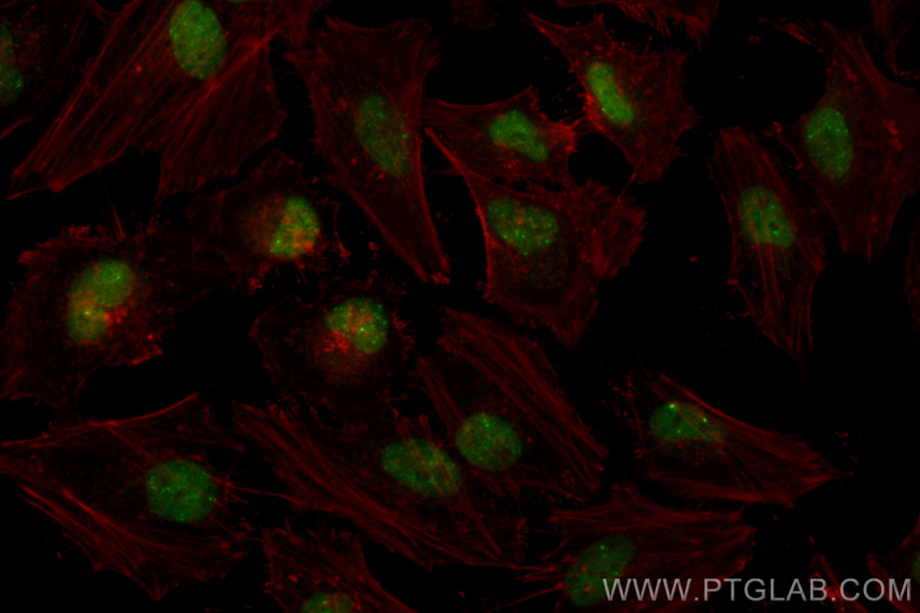 Immunofluorescence (IF) / fluorescent staining of HeLa cells using CoraLite® Plus 488-conjugated TP53BP1-Specific Rec (CL488-83809)