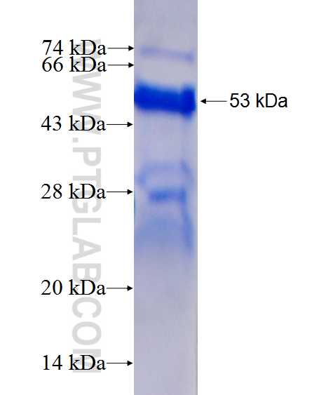 TP53BP2 fusion protein Ag24907 SDS-PAGE