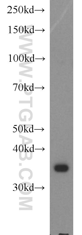 Western Blot (WB) analysis of HeLa cells using PIG3 Polyclonal antibody (14828-1-AP)