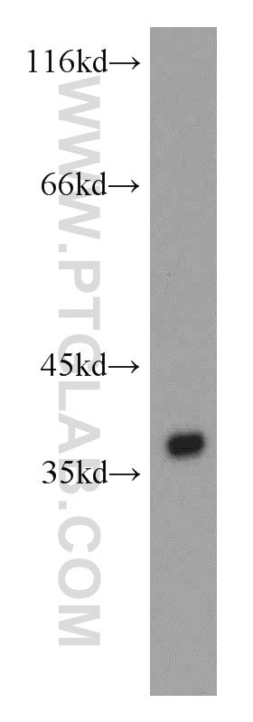 Western Blot (WB) analysis of SMMC-7721 cells using PIG3 Polyclonal antibody (14828-1-AP)