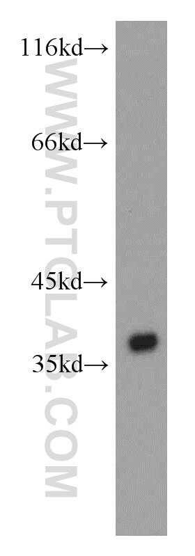 WB analysis of SMMC-7721 using 14828-1-AP