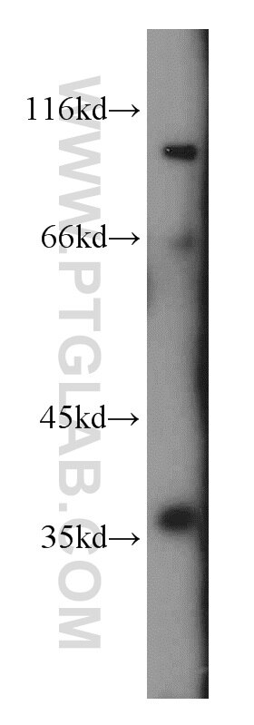 Western Blot (WB) analysis of HepG2 cells using PIG3 Polyclonal antibody (14828-1-AP)