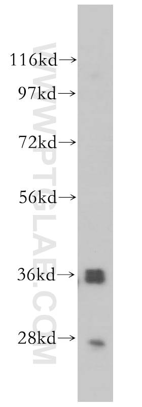 Western Blot (WB) analysis of HeLa cells using PIG3 Polyclonal antibody (14828-1-AP)