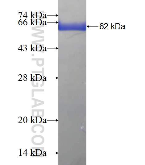 TP53I3 fusion protein Ag6618 SDS-PAGE