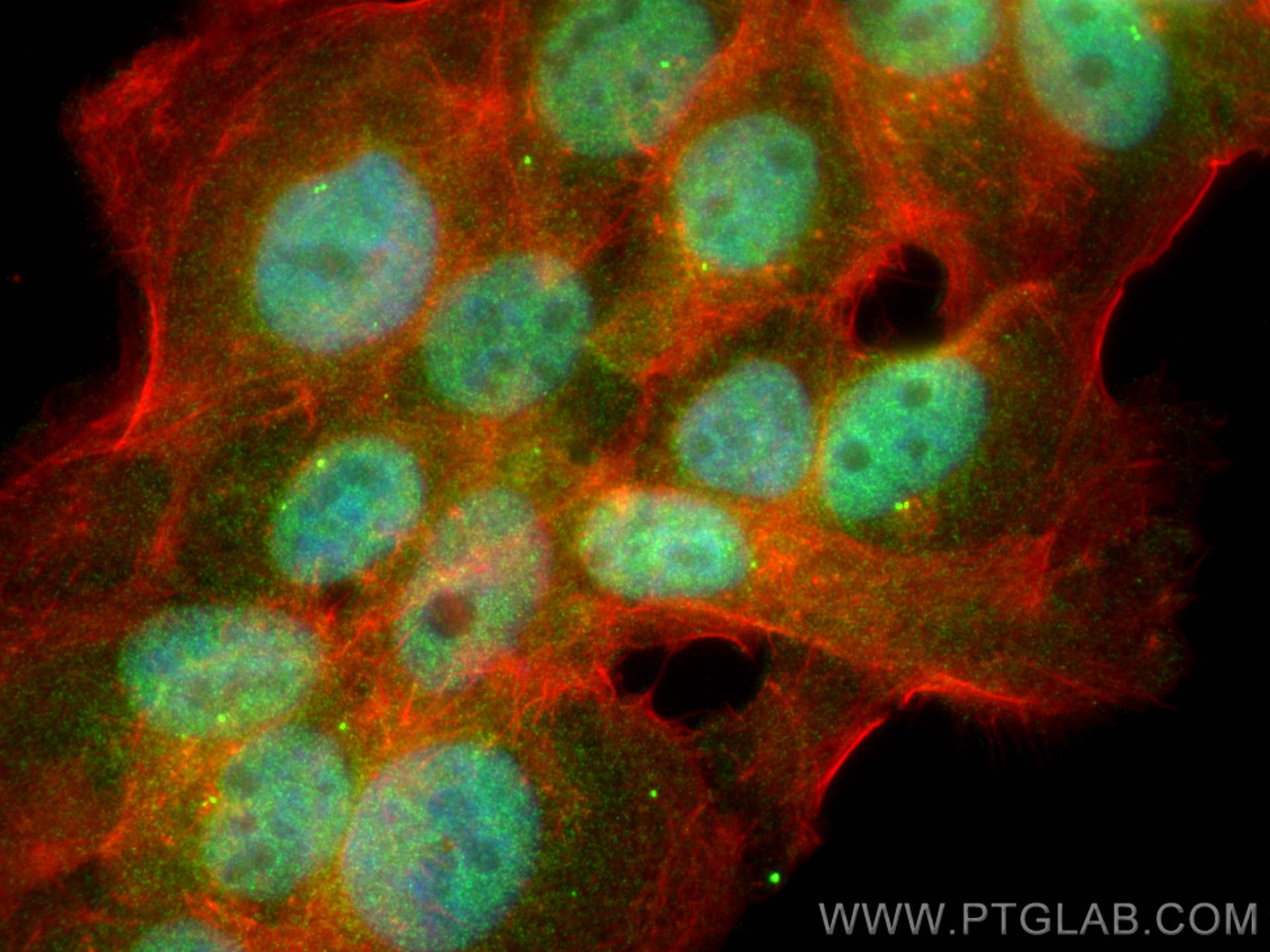 Immunofluorescence (IF) / fluorescent staining of A431 cells using TP53INP1 Polyclonal antibody (17872-1-AP)