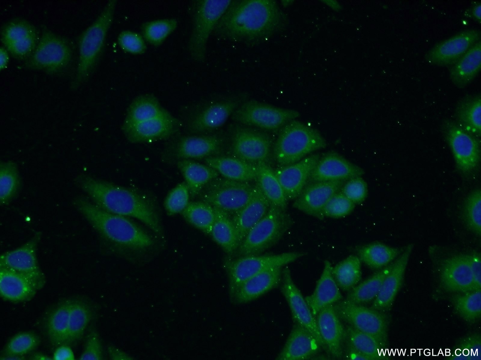 Immunofluorescence (IF) / fluorescent staining of HepG2 cells using TP53INP1 Polyclonal antibody (17872-1-AP)