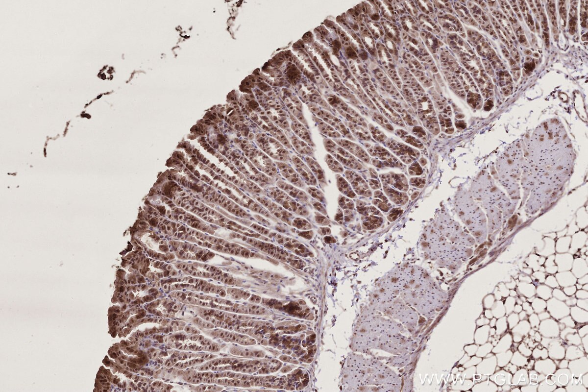 Immunohistochemistry (IHC) staining of mouse stomach tissue using TP53INP1 Polyclonal antibody (17872-1-AP)