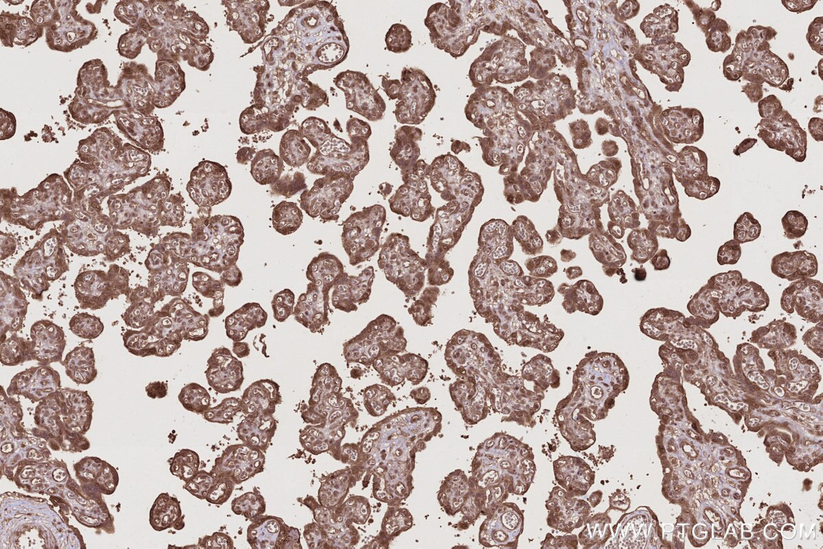 Immunohistochemistry (IHC) staining of human placenta tissue using TP53INP1 Polyclonal antibody (17872-1-AP)