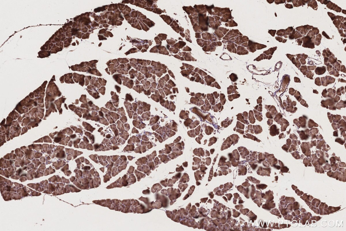 Immunohistochemistry (IHC) staining of mouse pancreas tissue using TP53INP1 Polyclonal antibody (17872-1-AP)