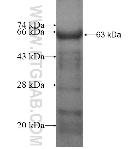 TP53INP1 fusion protein Ag12358 SDS-PAGE